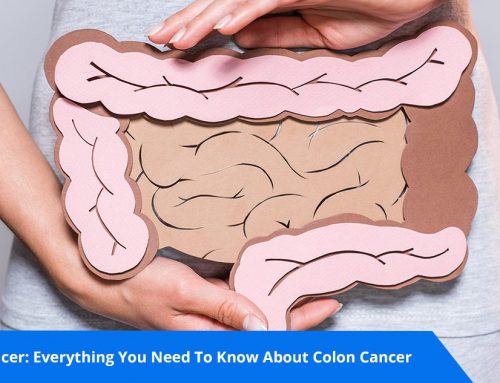 Colon Cancer: Everything You Need to Know About Colon Cancer