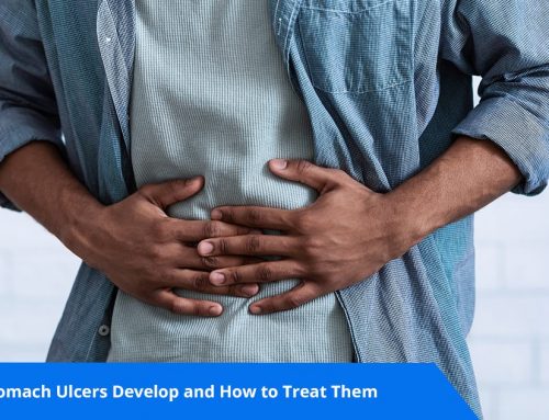 Why Stomach Ulcers Develop and How to Treat Them