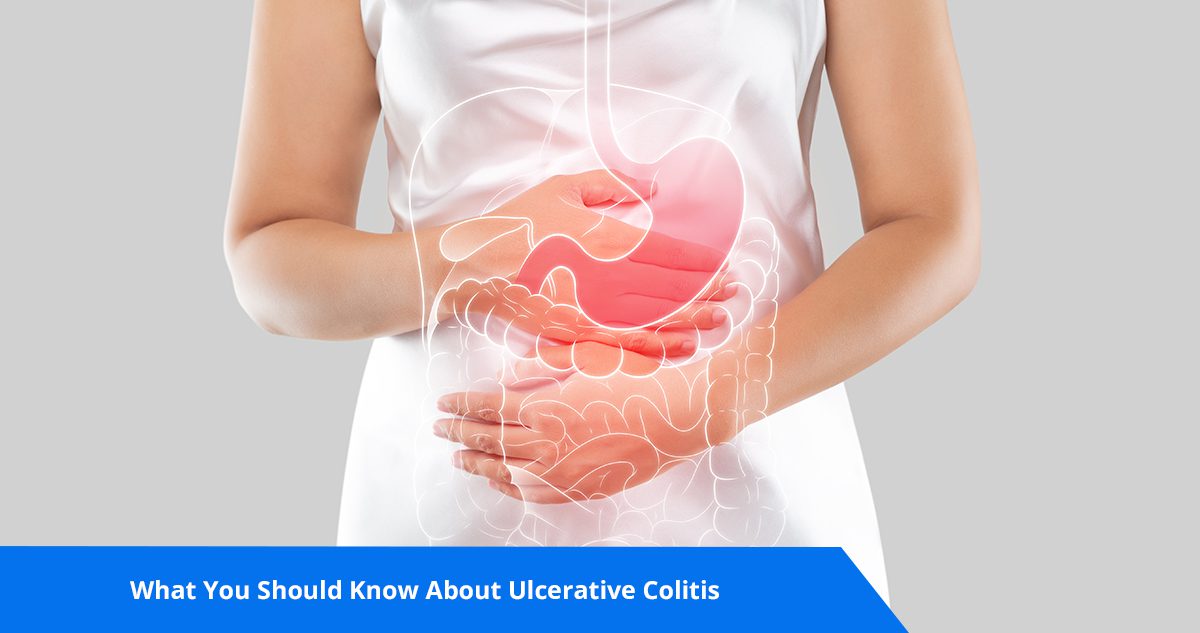 What You Should Know About Ulcerative Colitis